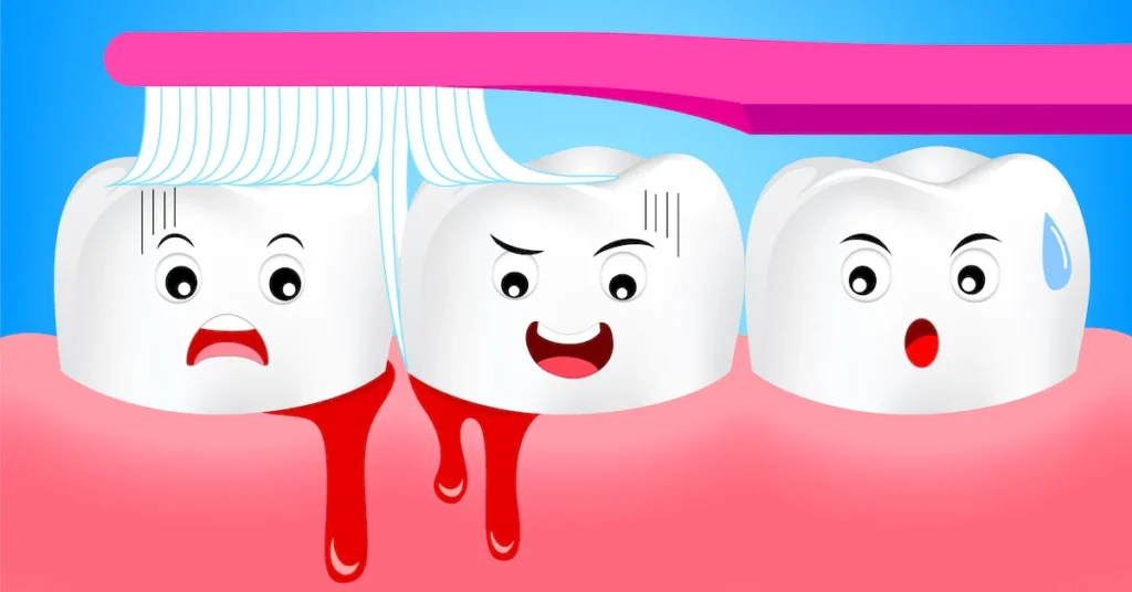 Is Bleeding Gums an Early Sign of Gum Disease Cheltenham?