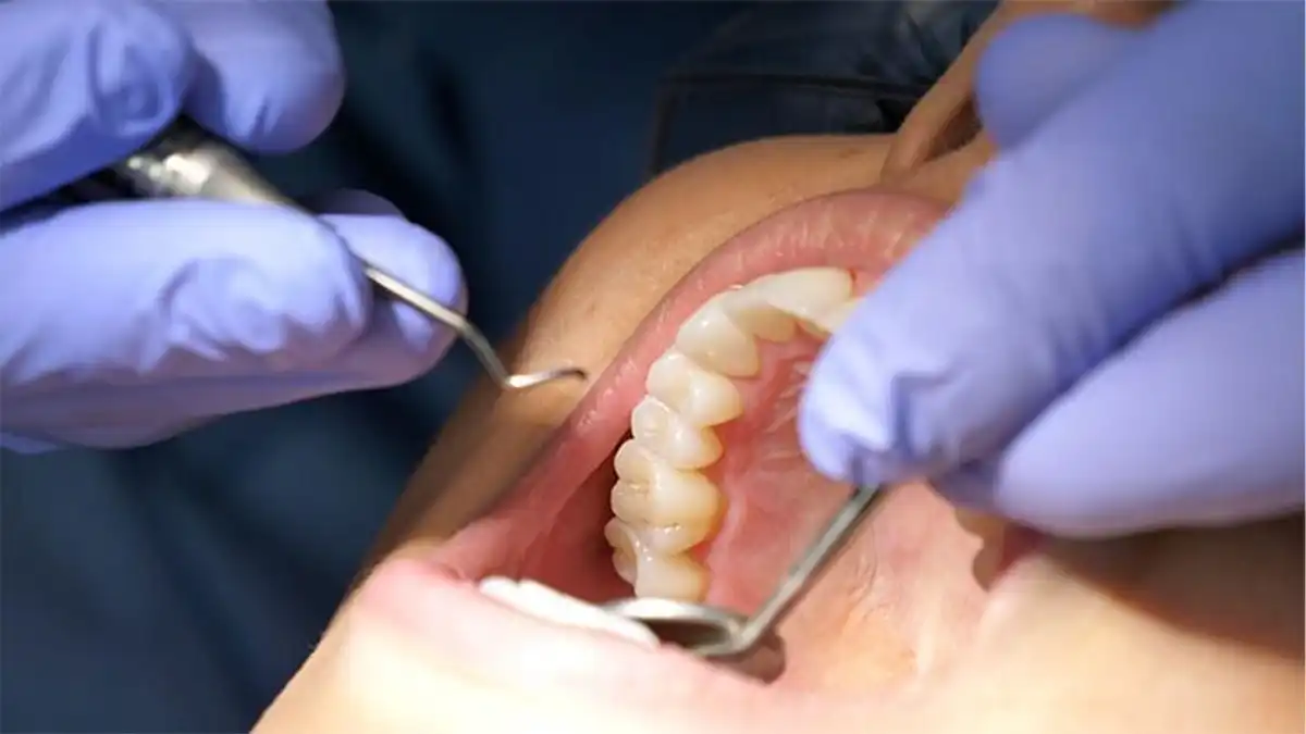 What's The Actual Difference Between Laser and Tray Teeth Whitening—And Why Should You Give a Floss Cheltenham?